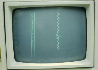 screen showing two traces