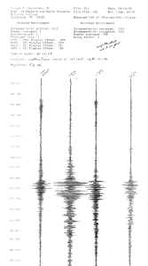 seismogram_sp_4_14_95.jpg (1237936 bytes)